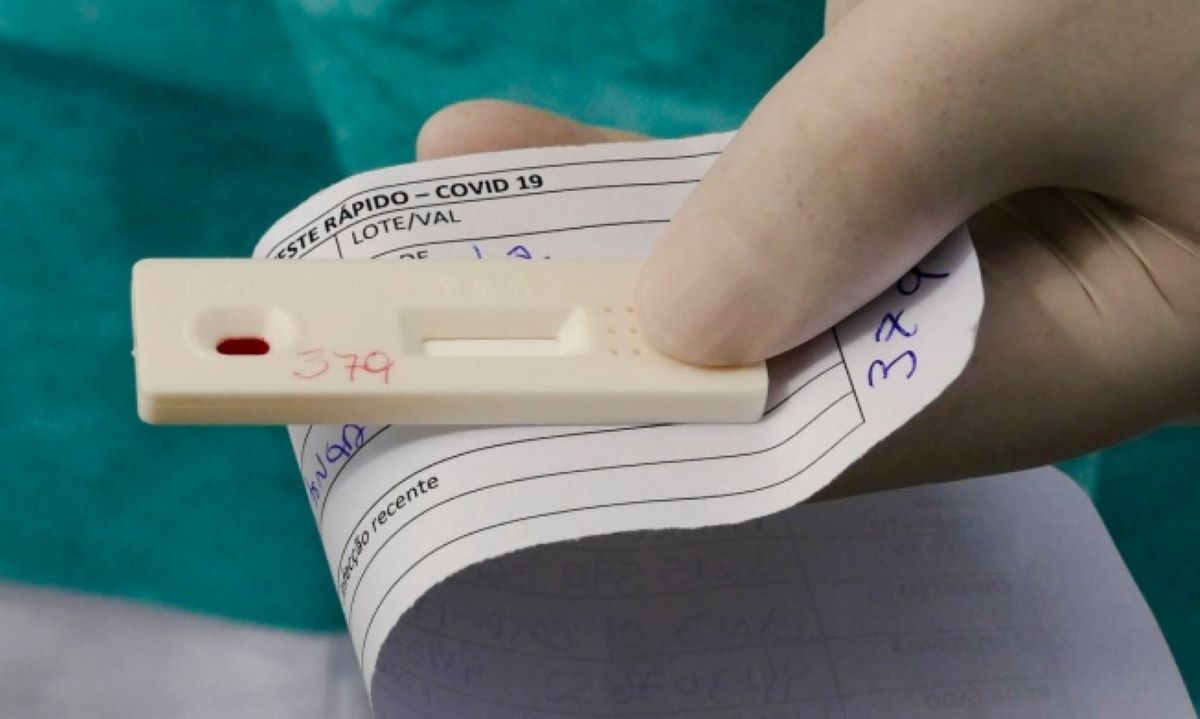 Pesquisa aponta que 12,5% da população mato-grossense já foi infectada pelo coronavírus