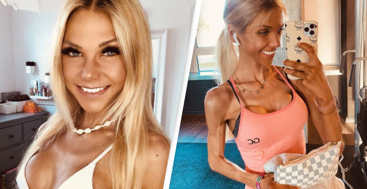 Perigo silencioso: morte de influencer acende alerta contra anorexia