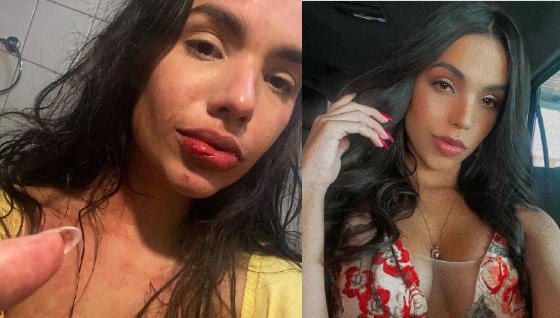 Influencer cuiabana chora, pede socorro e diz ter sido agredida por ‘enteado’ durante viagem; assista
