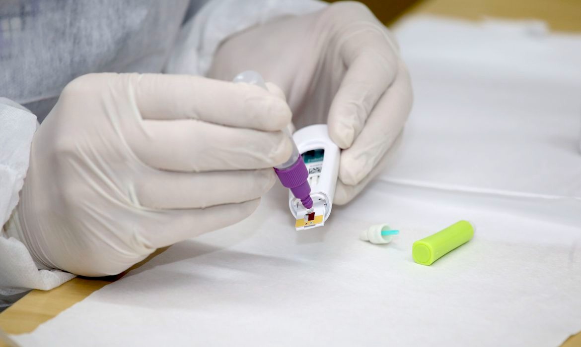Covid-19: prevenção ainda é necessária