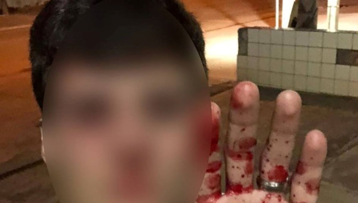 Mato Grosso | Casal denuncia policial militar por suposta agressão