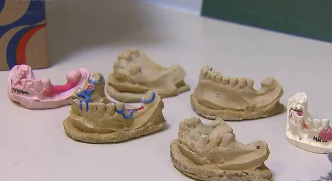 Suspeitos de “reciclar” próteses dentárias de cadáveres são presos no Rio de Janeiro