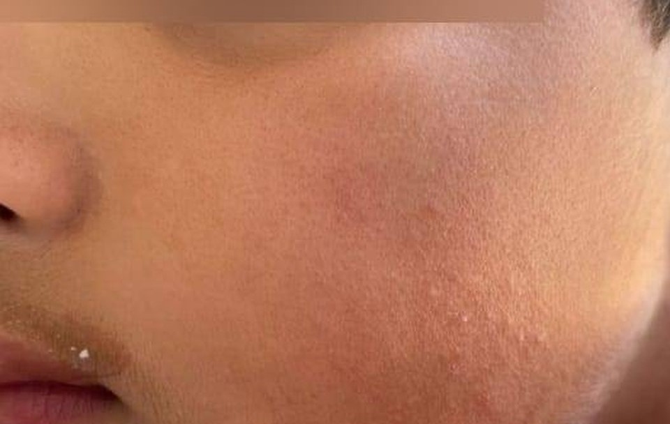 Mãe denuncia que filho foi agredido por pais de outra criança em parquinho de restaurante em Cuiabá