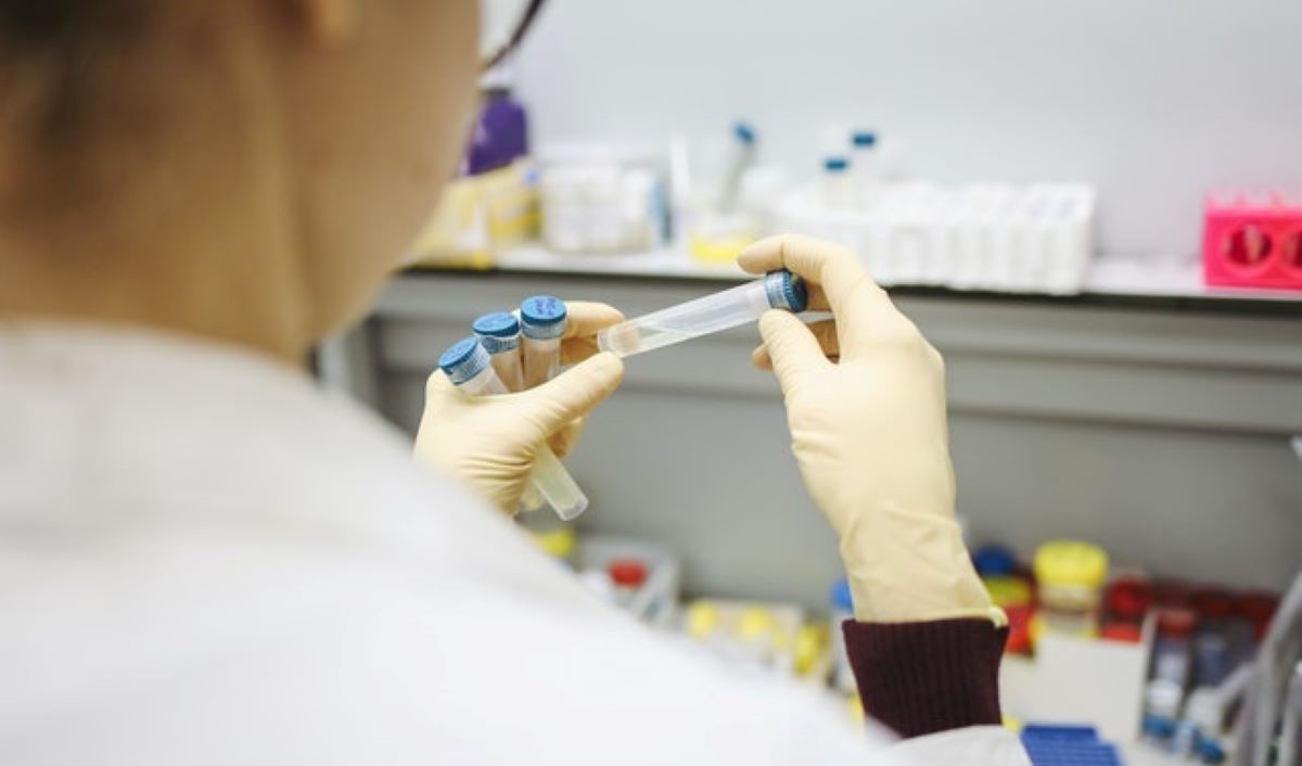 Você sabia que muitos exames de sangue não precisam de jejum para serem realizados?