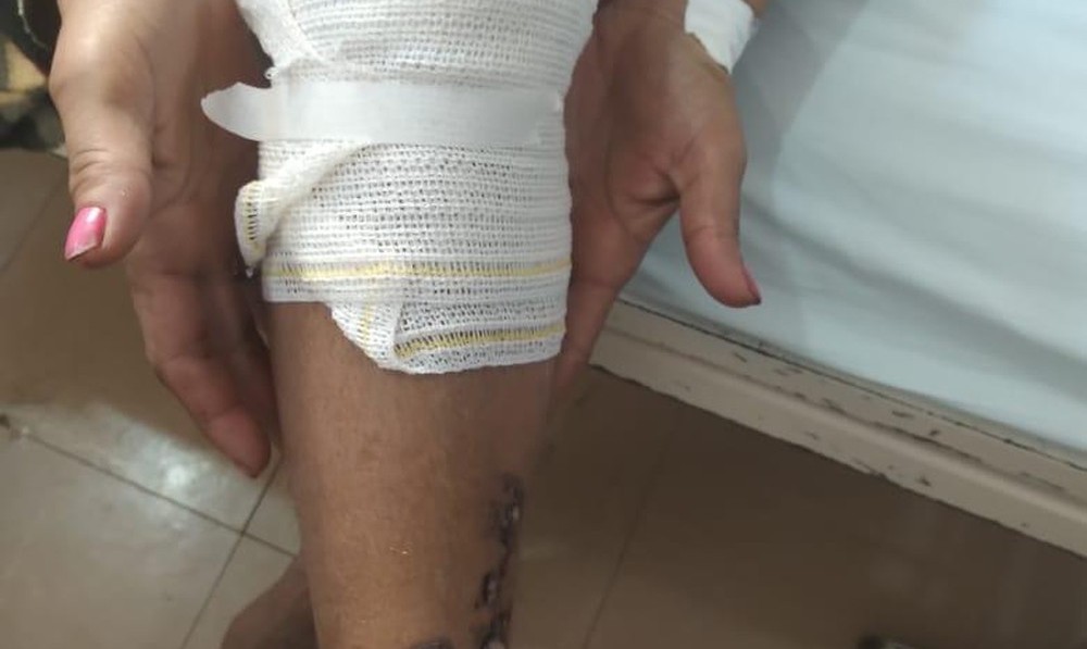 Dom Aquino | Mulher é jogada em fogueira de festa junina após discutir com a amante do marido