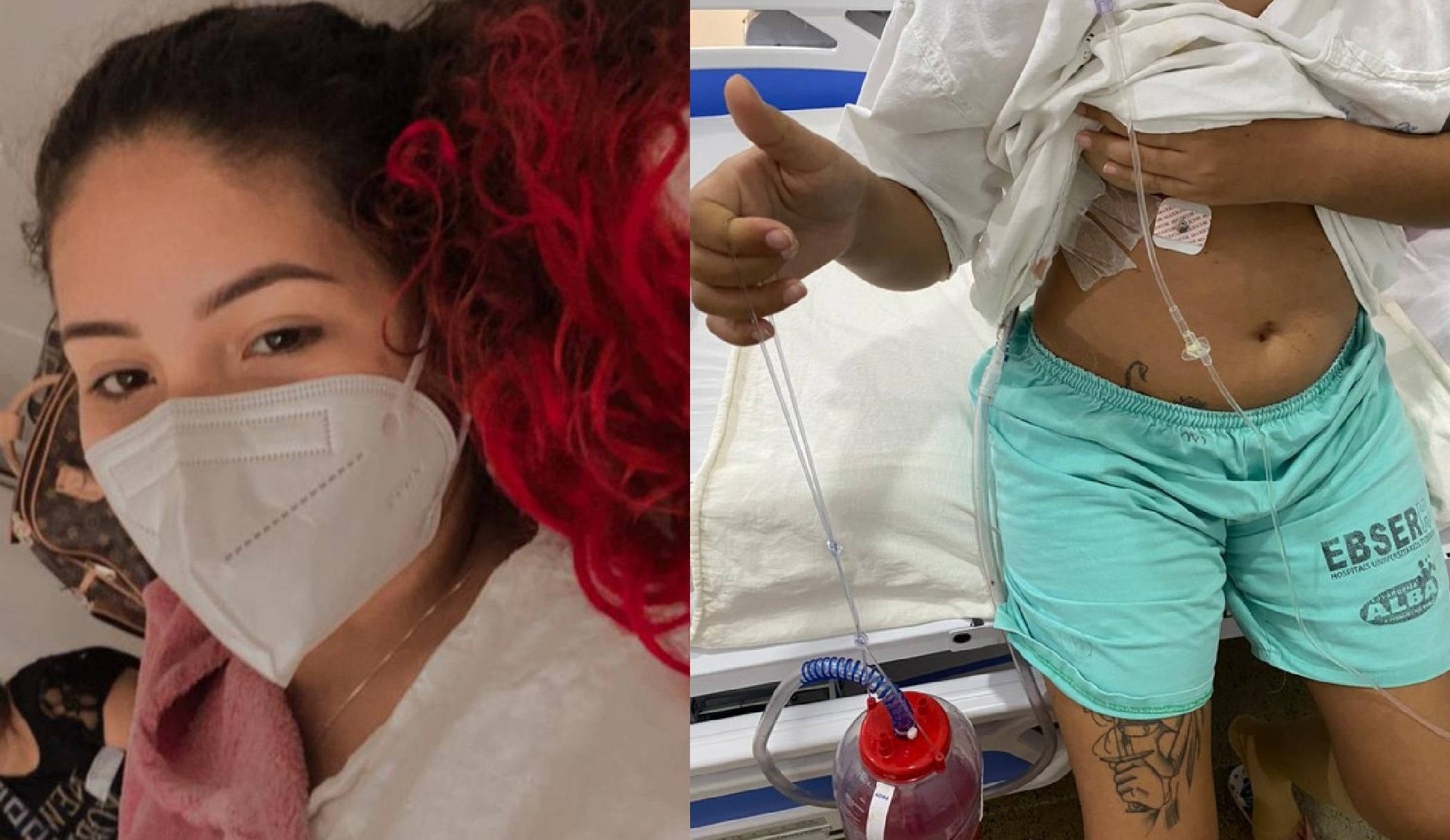 Cuiabá | ‘Espero melhorar’, diz jovem de 19 anos sobre rotina após ter parte do pulmão retirada por fungo causado por narguilé