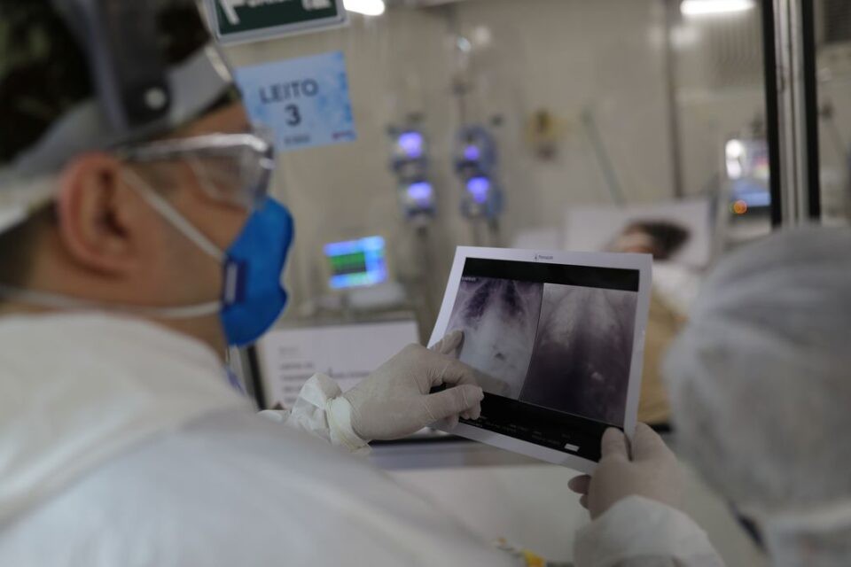 Inteligência artificial ajuda a agilizar exames de AVC