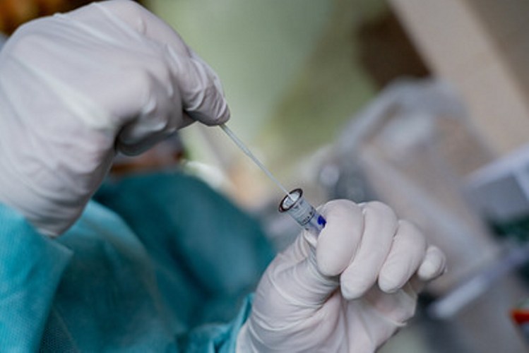 Sinop | Testes para identificação da Covid-19 ficam restritos para casos graves