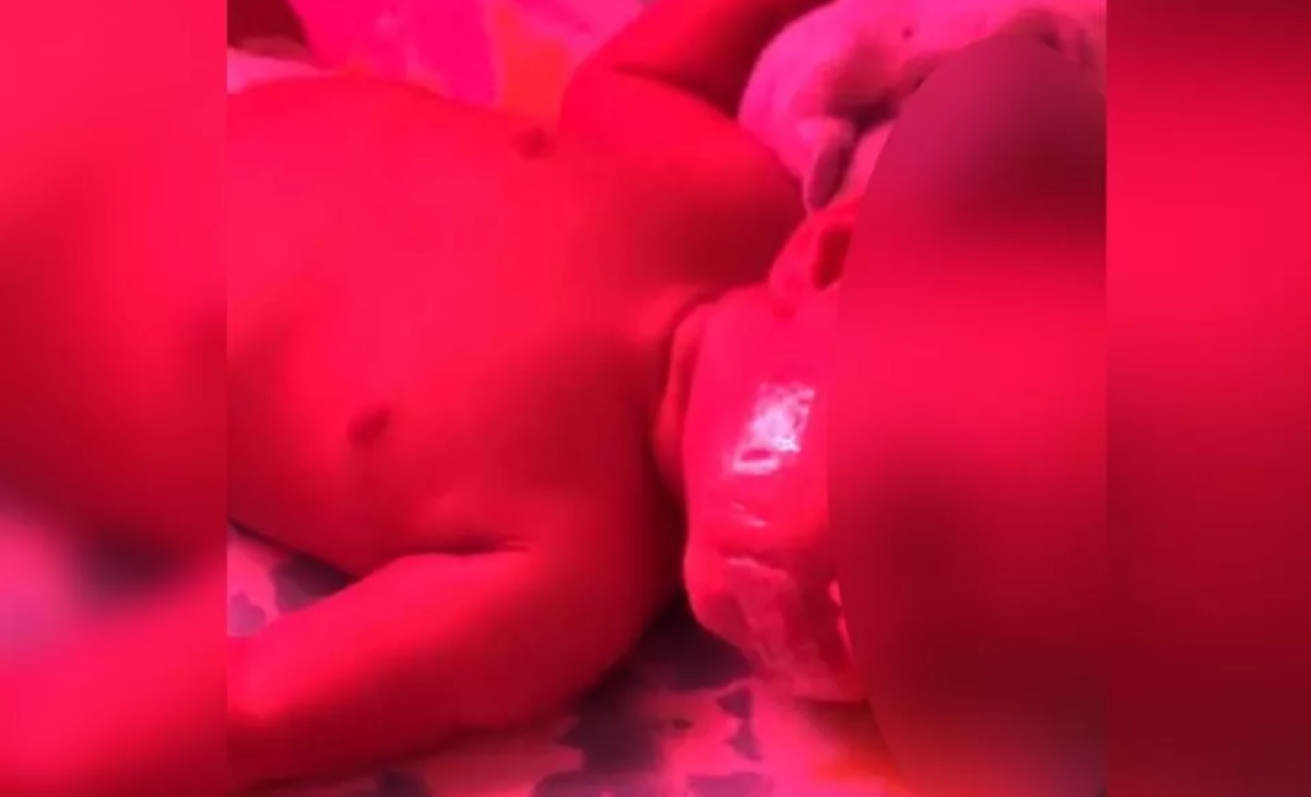 Mato Grosso | Mãe cola fita adesiva para tapar a boca da filha de 6 meses