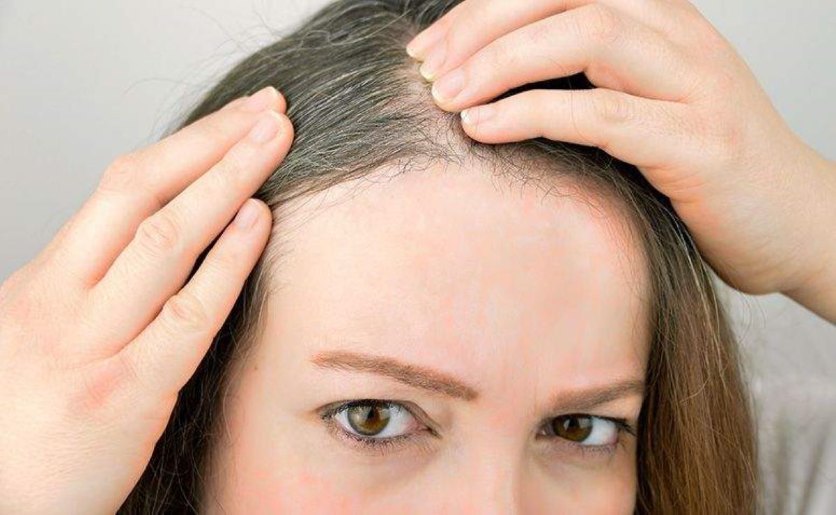 Como a falta de sono pode ocasionar queda de cabelo?