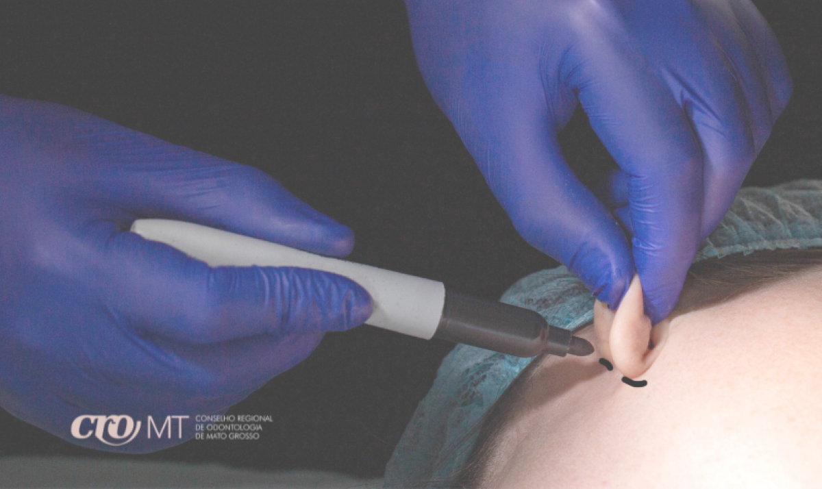 CRO-MT alerta Cirurgiões-Dentistas com relação a procedimentos de  Harmonização Orofacial