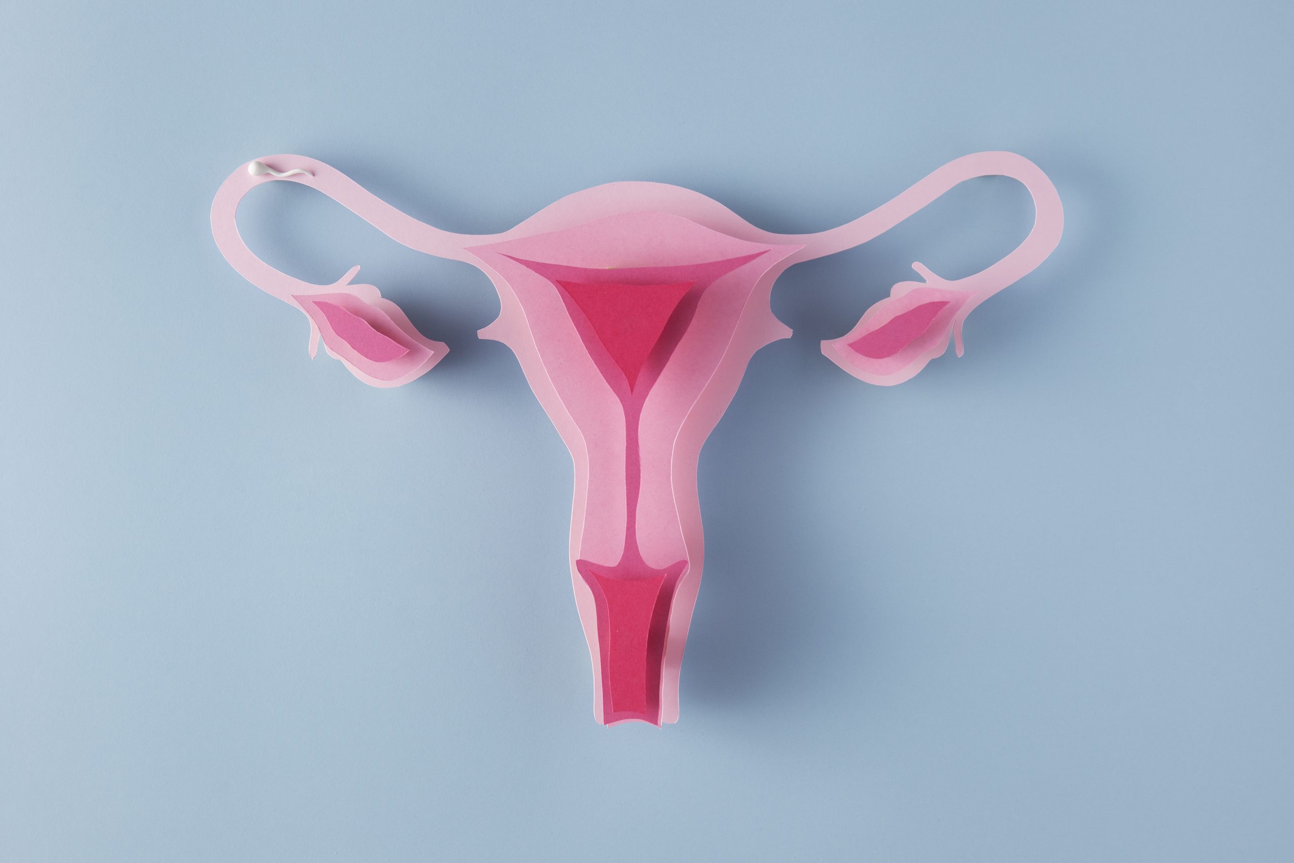 Endometriose: a doença que afeta a fertilidade nas mulheres