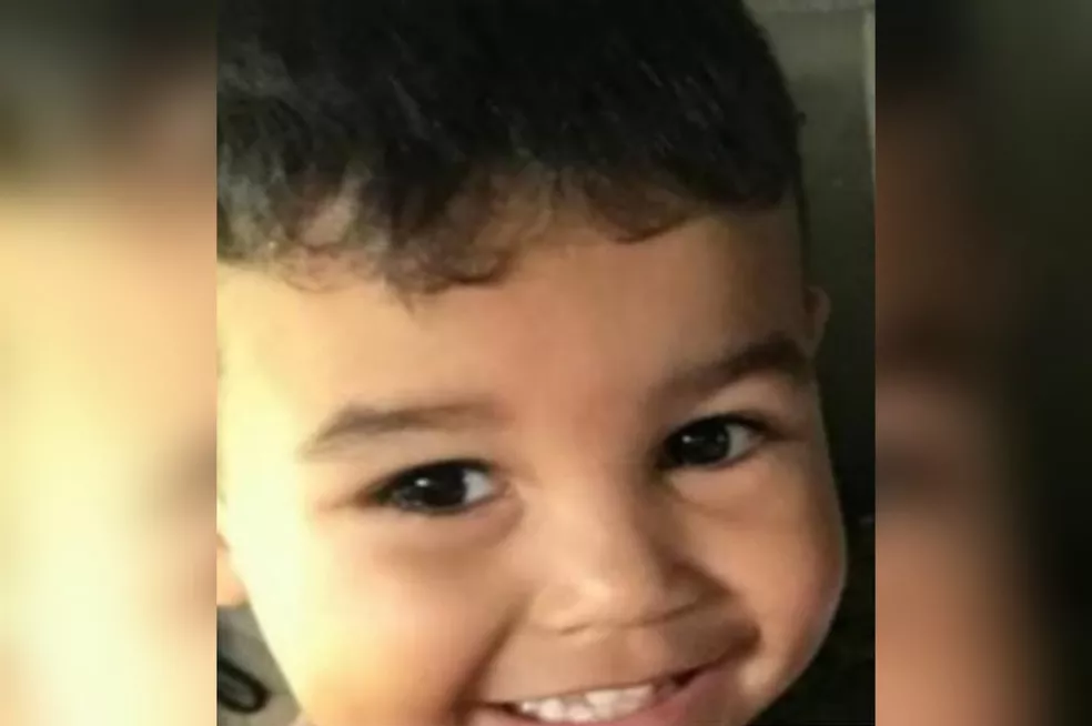 Sinop´| Menino de 3 anos morre após tropeçar em churrasqueira e sofrer queimaduras