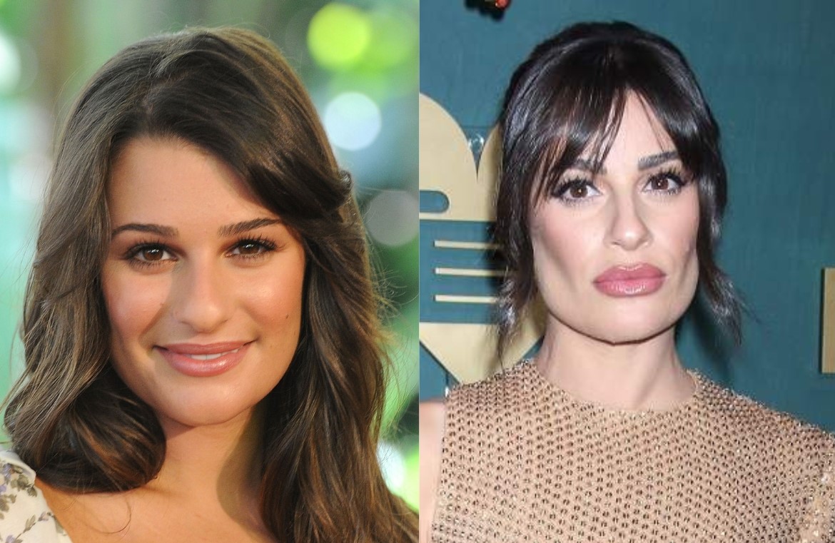 Buccal Fat Removal: o que é o procedimento que virou pauta no TikTok?