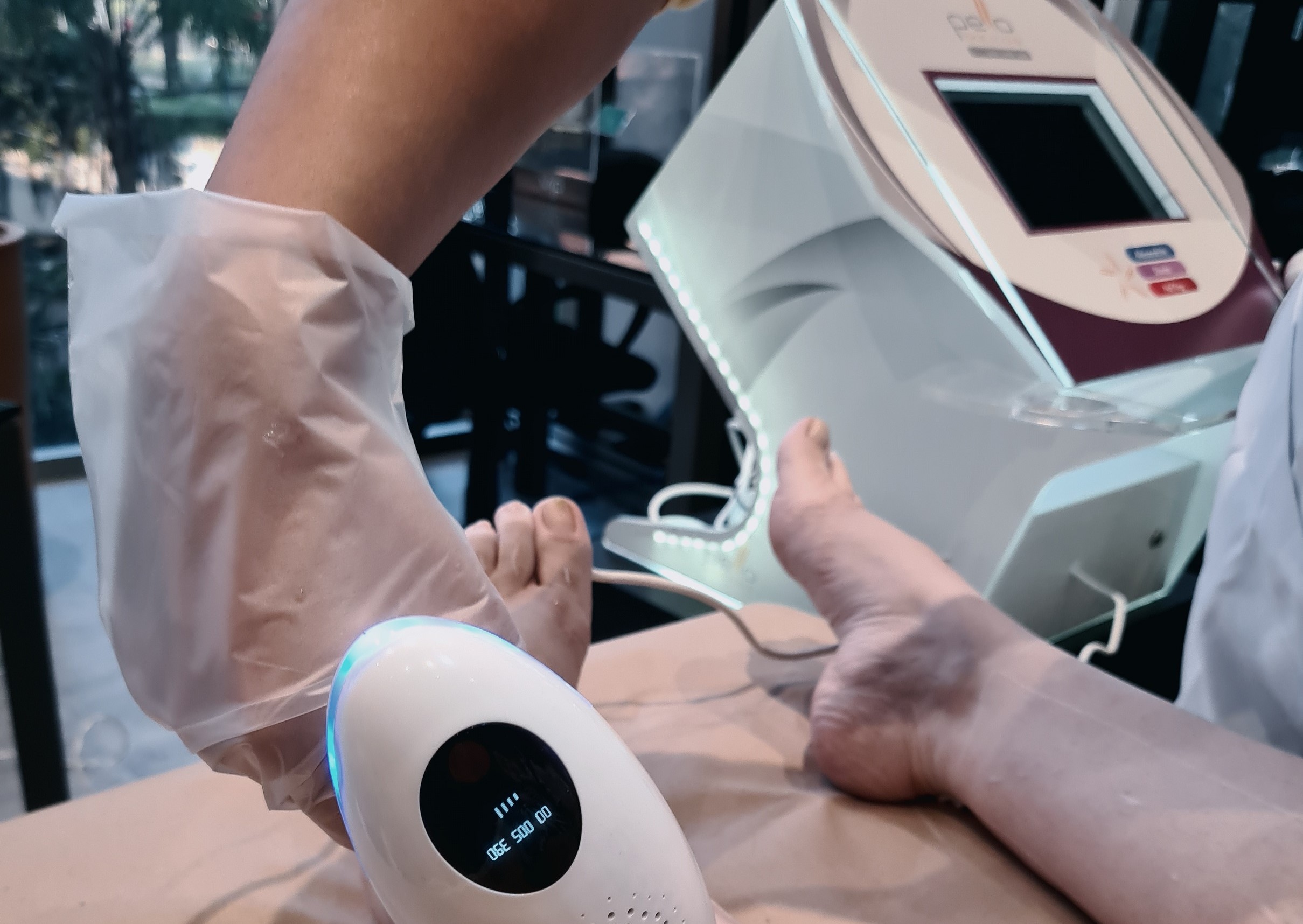 Descubra o momento ideal para realizar a depilação à laser