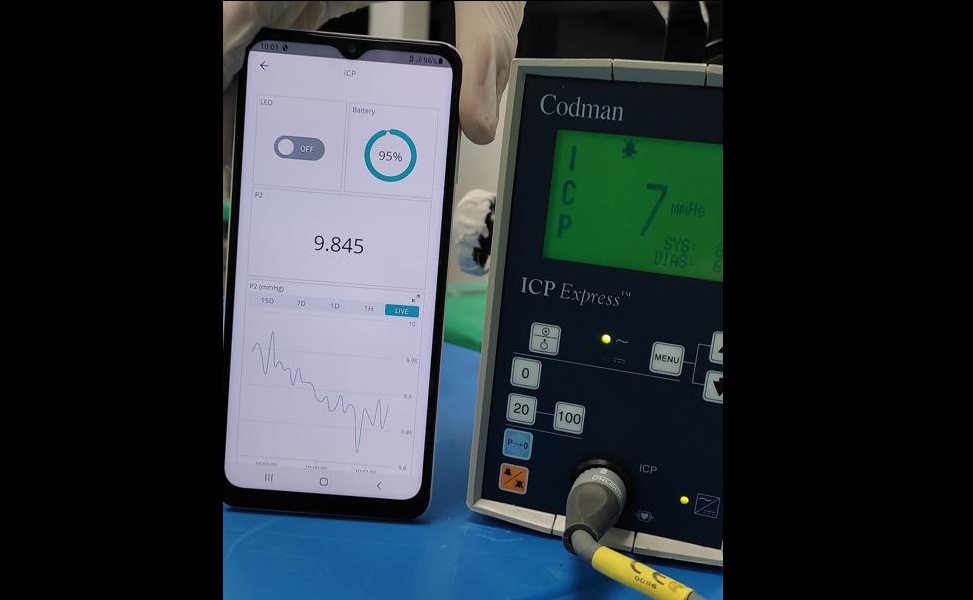 Brasileiro desenvolve sensor que mede pressão intracraniana por Wi-Fi