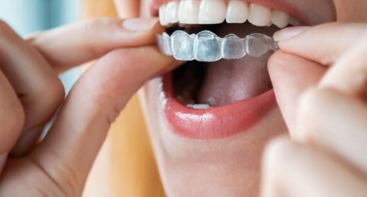 Bruxismo: confira opções de tratamento