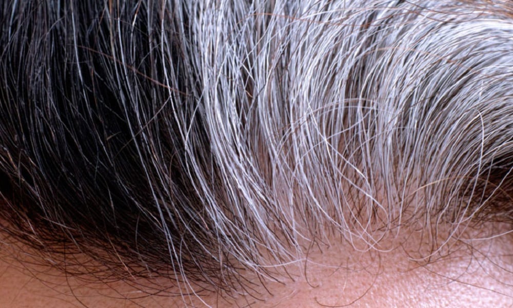 Cientistas dos Estados Unidos descobrem que cabelo branco é reversível