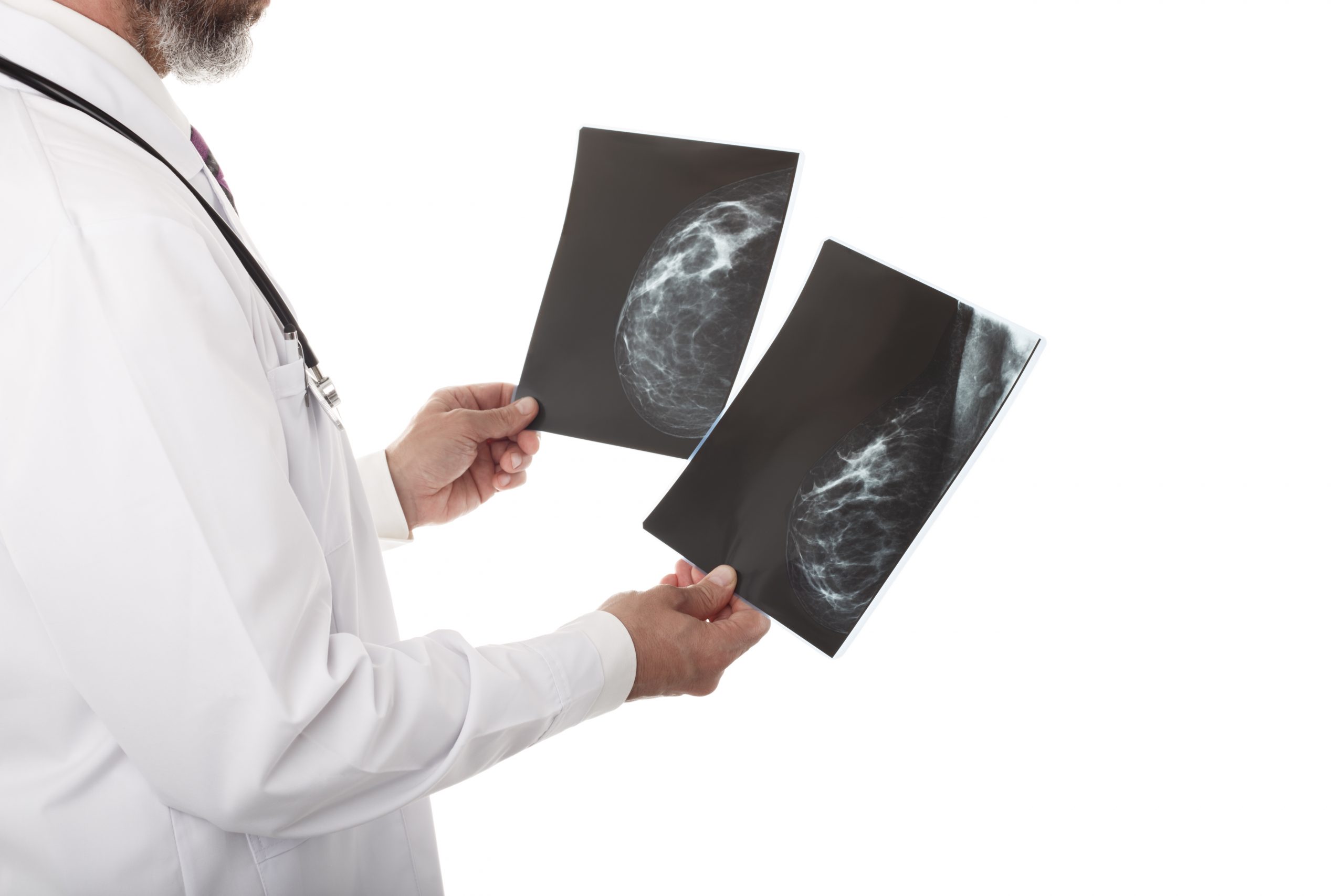 Resultados de mamografia devem ser entregues com imagens impressas