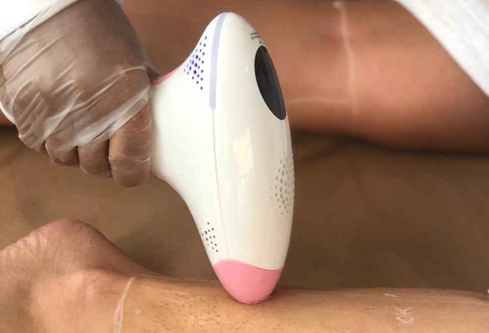 Conheça os mitos e verdades sobre depilação a laser