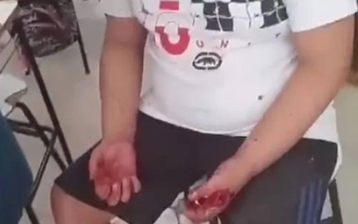 Sinop | Aluno com autismo tem crise de ansiedade e é agredido por professor em escola