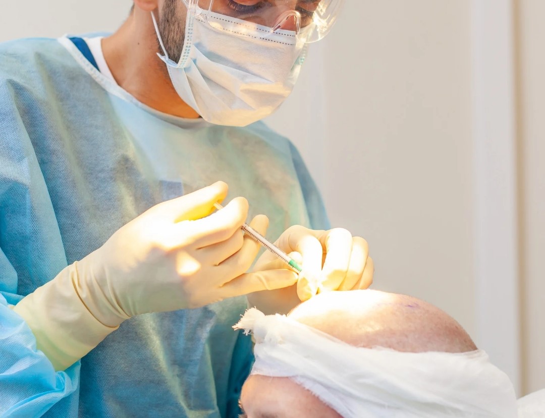 Quais os cuidados após o transplante capilar durante o verão?