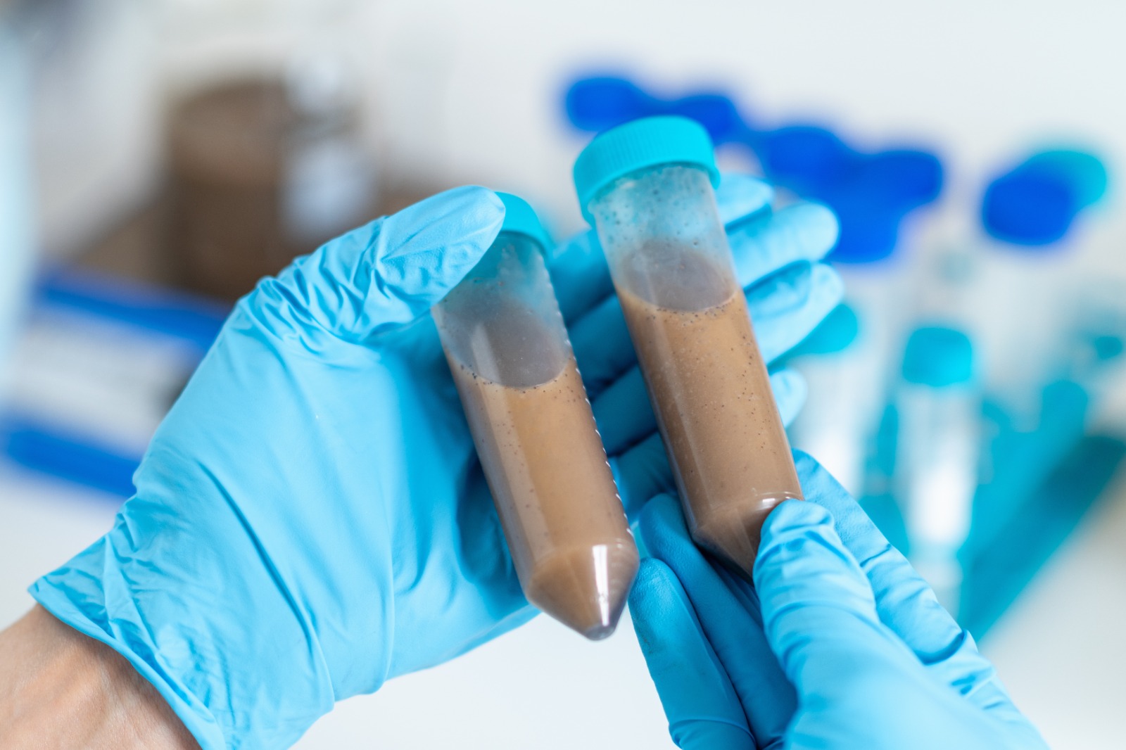 Transplante de fezes avança no SUS como opção de tratamento para infecções resistentes a antibióticos