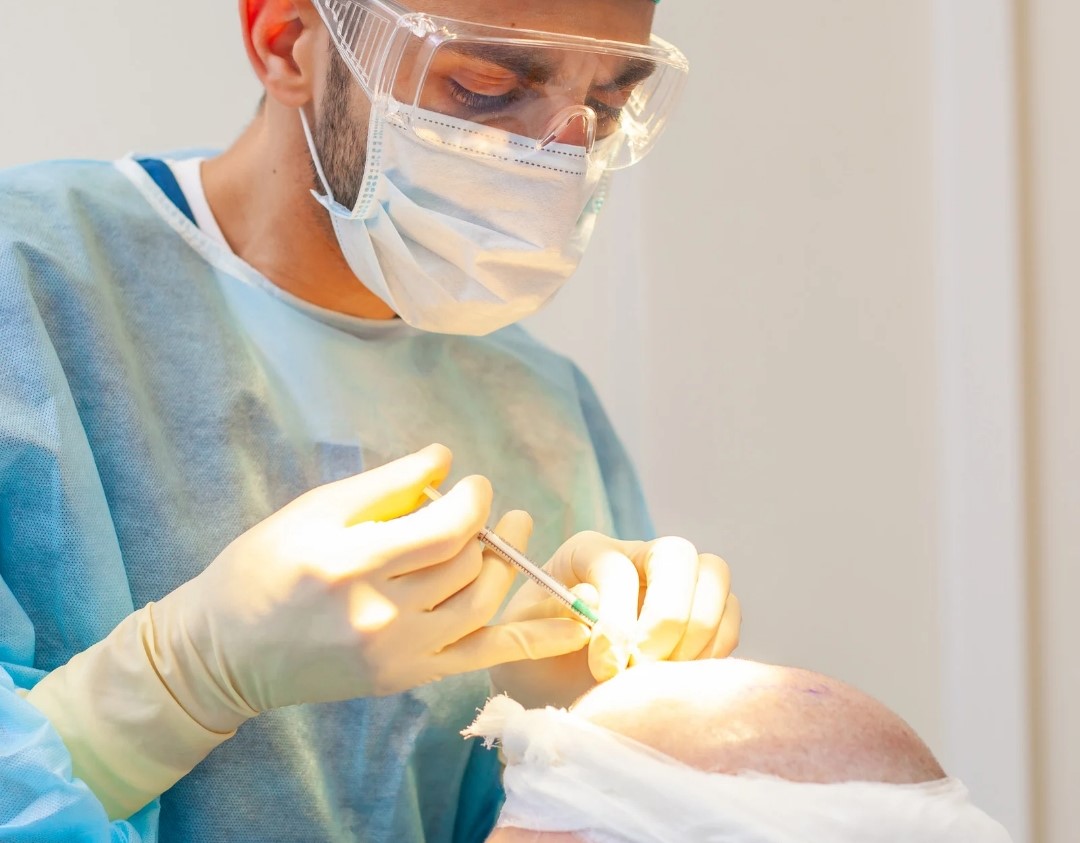 Quais os cuidados após o transplante capilar durante o verão?