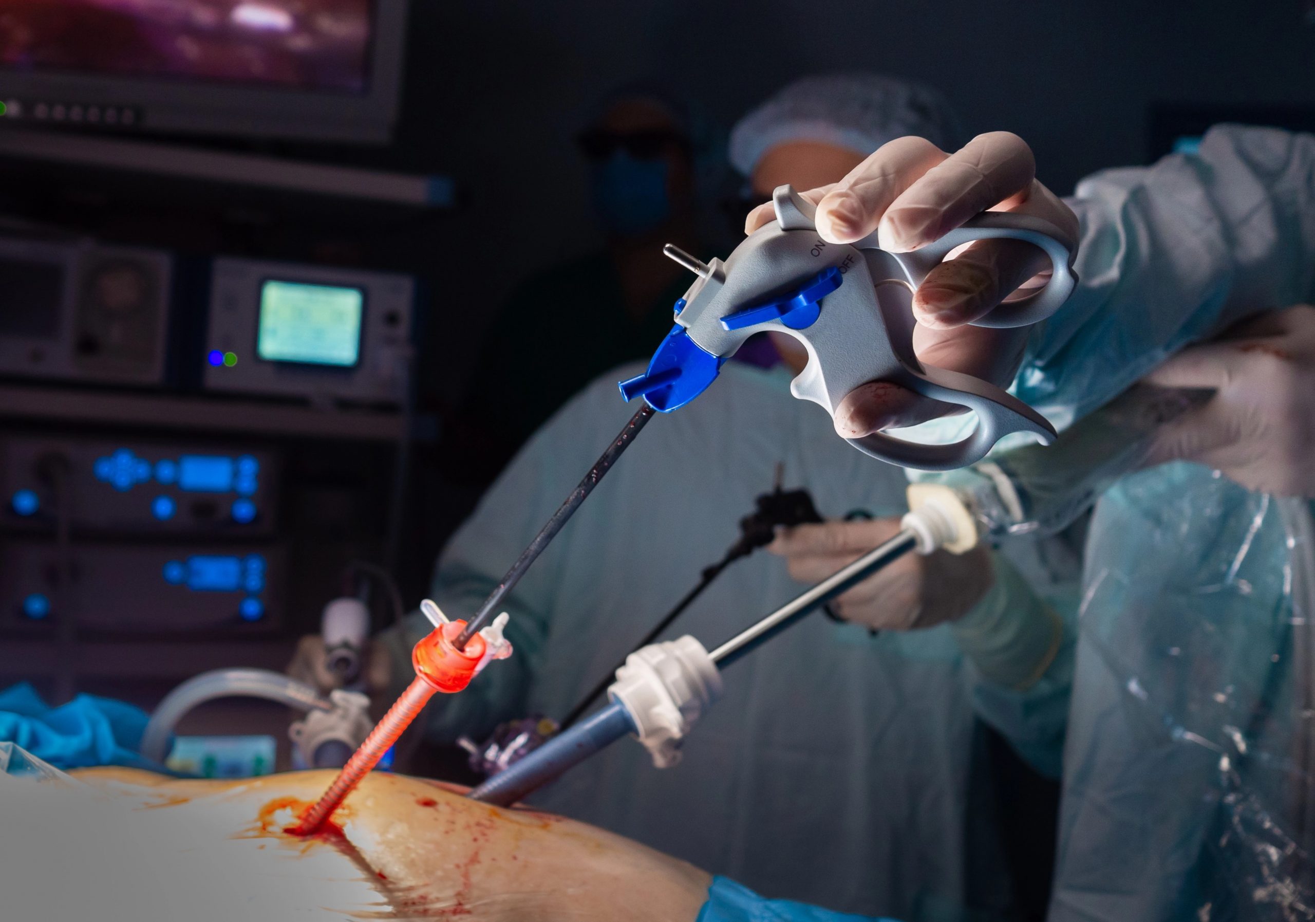 Apenas 1 a cada 4 pacientes recebem tratamento cirúrgico adequado e antes do câncer evoluir