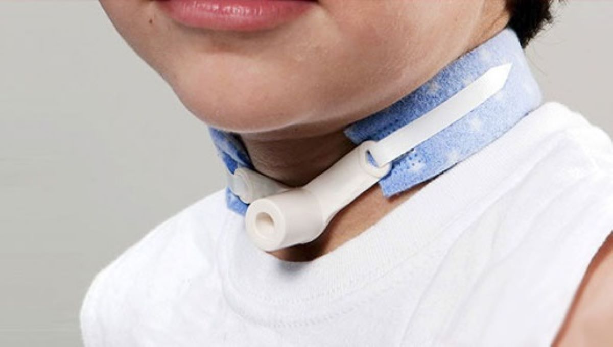 Criança traqueostomizada requer cuidados especiais para viver com saúde e bem-estar