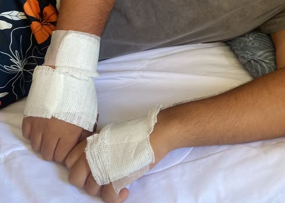 Jovem fica ferido após ser atacado por pitbull durante passeio com outro cão em Cuiabá