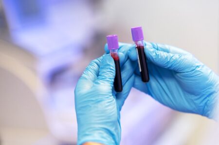 IA inédita que agiliza o diagnóstico de doenças no sangue é destaque em Lisboa