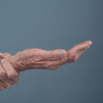 Elderly women with pain.