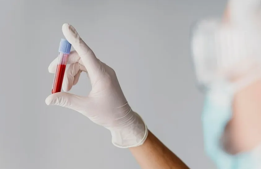 Novo exame de sangue pode detectar Alzheimer anos antes dos sintomas exame de sangue