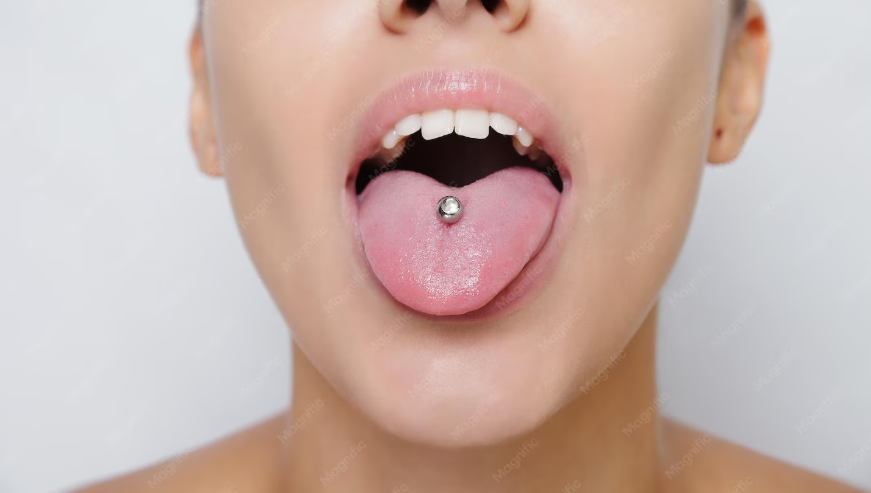 Piercing na boca pode prejudicar dentes e gengivas? Veja os cuidados unnamed(1)